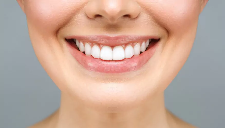 After dental transformation